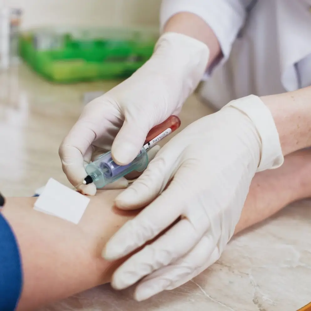 Comprehensive Vitamin Profile Test in Dubai by Life Aid